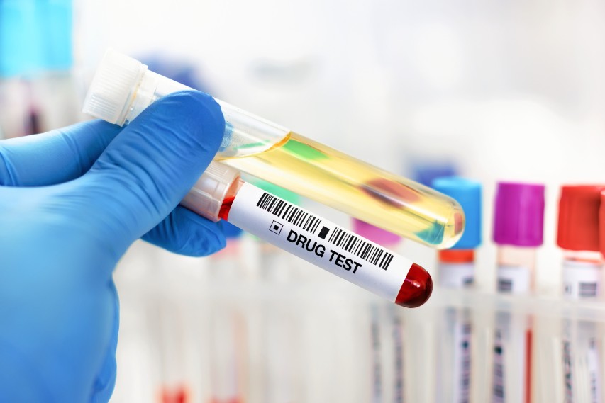 <strong>Instant Vs. Laboratory Drug Testing: What’s The Difference?</strong> laboratory drug testing
